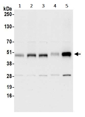 Western blot - Anti-WIPI2 antibody (AB241278)