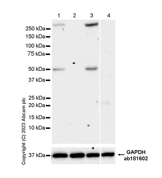 Western blot - Anti-WIPI2 (phospho S413) antibody [EPR27037-149] (AB310325)