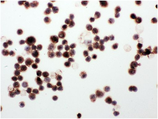 Immunocytochemistry - Anti-WISP1 antibody - C-terminal (AB178547), expandable thumbnail