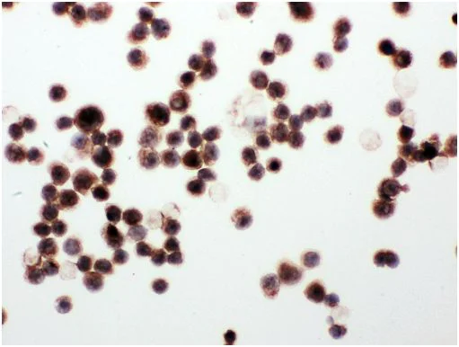 Immunocytochemistry - Anti-WISP1 antibody - C-terminal (AB178547)