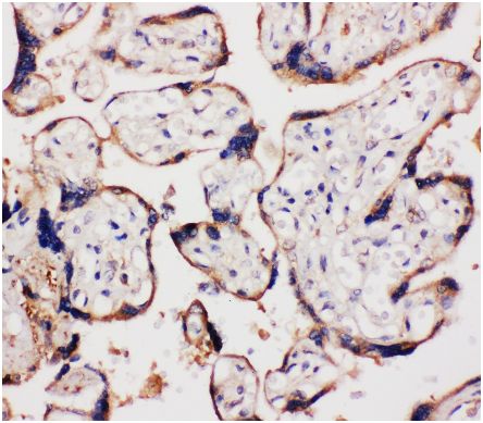 Immunohistochemistry (Formalin/PFA-fixed paraffin-embedded sections) - Anti-WISP1 antibody - C-terminal (ab178547), expandable thumbnail