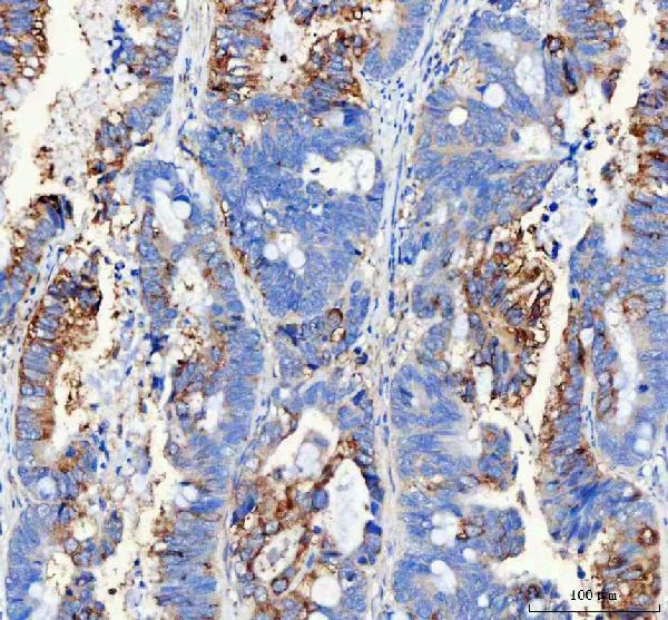 Immunohistochemistry (Formalin/PFA-fixed paraffin-embedded sections) - Anti-WISP1 antibody - C-terminal (ab178547), expandable thumbnail