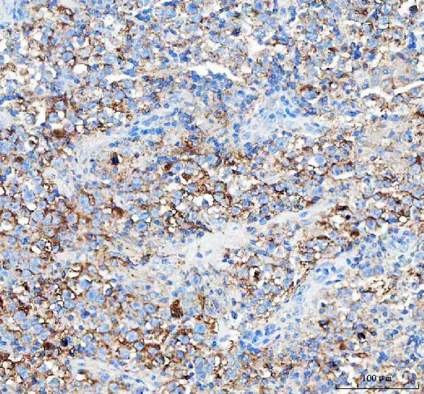 Immunohistochemistry (Formalin/PFA-fixed paraffin-embedded sections) - Anti-WISP1 antibody - C-terminal (ab178547), expandable thumbnail