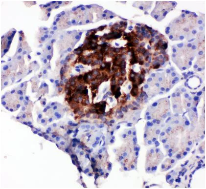 Immunohistochemistry (Formalin/PFA-fixed paraffin-embedded sections) - Anti-WISP1 antibody - C-terminal (AB178547)