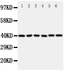 Western blot - Anti-WISP1 antibody - C-terminal (AB178547), expandable thumbnail