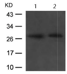 Western blot - Anti-WISP2 antibody (AB123375)