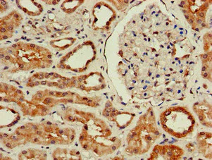 Immunohistochemistry (Formalin/PFA-fixed paraffin-embedded sections) - Anti-WISP3 antibody (AB224720)