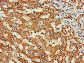 Immunohistochemistry (Formalin/PFA-fixed paraffin-embedded sections) - Anti-WISP3 antibody (AB224720)