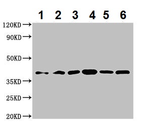 Western blot - Anti-WISP3 antibody (AB224720)