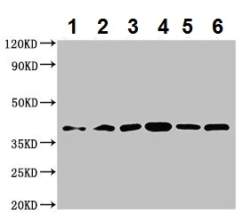 Western blot - Anti-WISP3 antibody (AB224720)