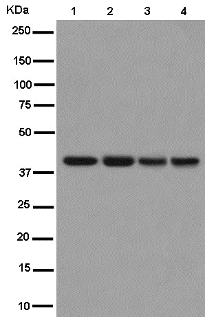 Western blot - Anti-WISP3 antibody [EPR14769] - BSA and Azide free (AB250940)