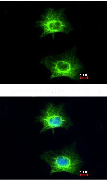 Immunocytochemistry/ Immunofluorescence - Anti-WNK1 antibody (AB137687)