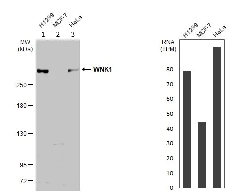 Western blot - Anti-WNK1 antibody (AB137687)