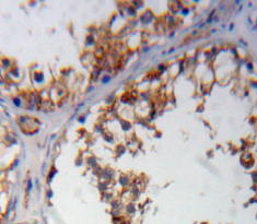 Immunohistochemistry (Formalin/PFA-fixed paraffin-embedded sections) - Anti-WNK1 antibody (AB233266)