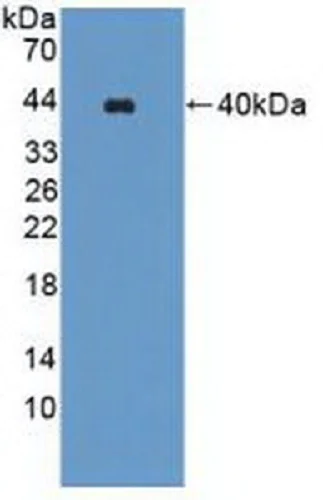 Western blot - Anti-WNK1 antibody (AB233266)