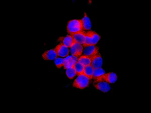 Immunocytochemistry/ Immunofluorescence - Anti-WNK1 antibody [EPR2743(3)] (AB174854)