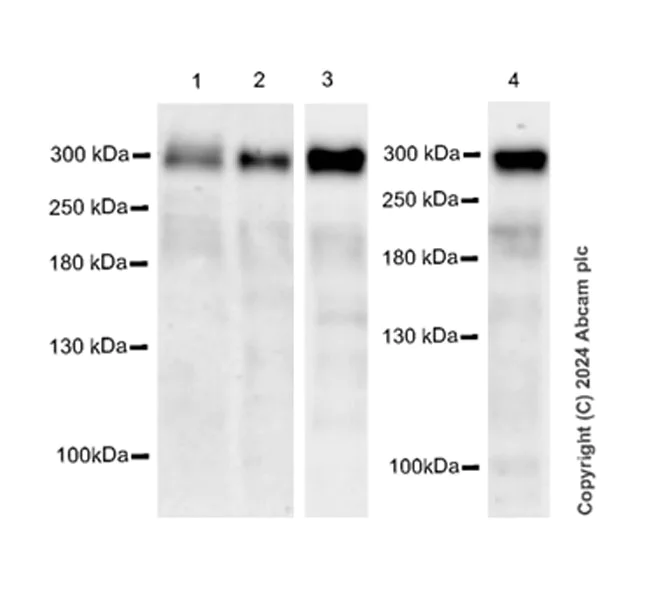 Western blot - Anti-WNK1 antibody [EPR28125-60] (AB316279)