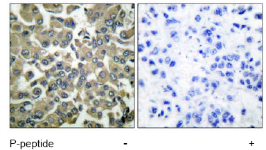 Immunohistochemistry (Formalin/PFA-fixed paraffin-embedded sections) - Anti-WNK1 (phospho T58) antibody (AB53137), expandable thumbnail