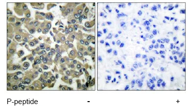 Immunohistochemistry (Formalin/PFA-fixed paraffin-embedded sections) - Anti-WNK1 (phospho T58) antibody (AB53137)