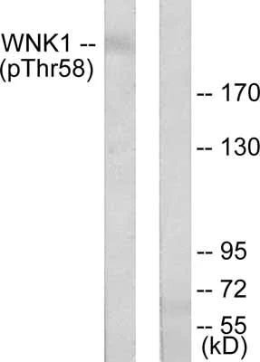 Western blot - Anti-WNK1 (phospho T58) antibody (AB53137)