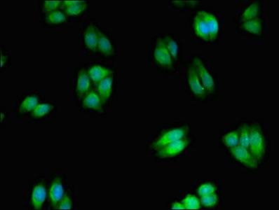 Immunocytochemistry/ Immunofluorescence - Anti-WNK2 antibody (AB239037)