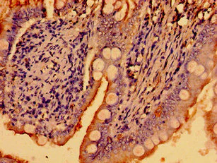 Immunohistochemistry (Formalin/PFA-fixed paraffin-embedded sections) - Anti-WNK2 antibody (AB239037)