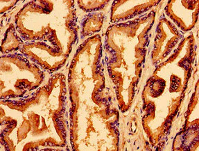 Immunohistochemistry (Formalin/PFA-fixed paraffin-embedded sections) - Anti-WNK2 antibody (AB239037)