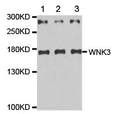 Western blot - Anti-WNK3 antibody (AB187503)