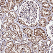 Immunohistochemistry (Formalin/PFA-fixed paraffin-embedded sections) - Anti-WNK4 antibody (AB126477)