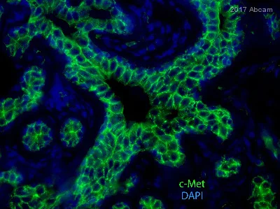 Immunohistochemistry (Formalin/PFA-fixed paraffin-embedded sections) - Wnt/Beta Catenin Signaling Pathway Antibody Sampler Panel (AB228526)