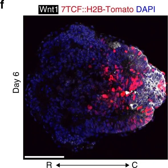 Immunohistochemistry - Anti-Wnt1 antibody (AB15251)