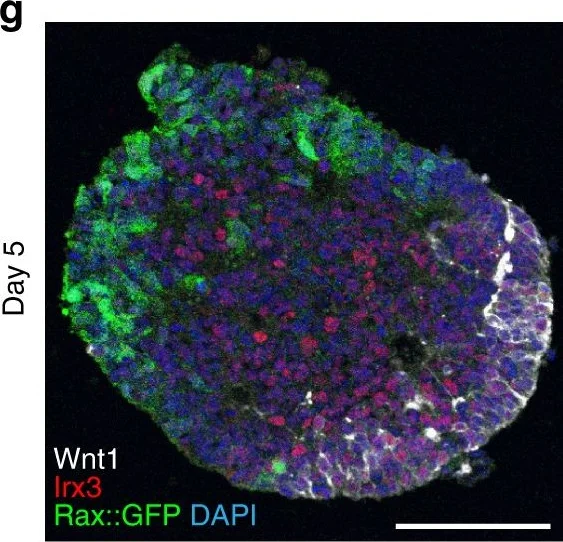 Immunohistochemistry - Anti-Wnt1 antibody (AB15251)