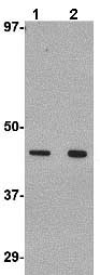 Anti-Wnt10a antibody