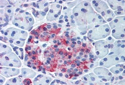 Immunohistochemistry (Formalin/PFA-fixed paraffin-embedded sections) - Anti-Wnt10a antibody (AB189015)
