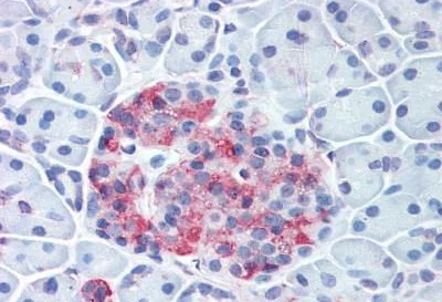Immunohistochemistry (Formalin/PFA-fixed paraffin-embedded sections) - Anti-Wnt10a antibody (AB189015)