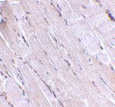 Immunohistochemistry (Formalin/PFA-fixed paraffin-embedded sections) - Anti-Wnt10b antibody (AB70816), expandable thumbnail