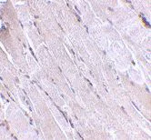 Immunohistochemistry (Formalin/PFA-fixed paraffin-embedded sections) - Anti-Wnt10b antibody (AB70816)