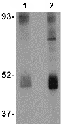 Western blot - Anti-Wnt10b antibody (AB70816), expandable thumbnail