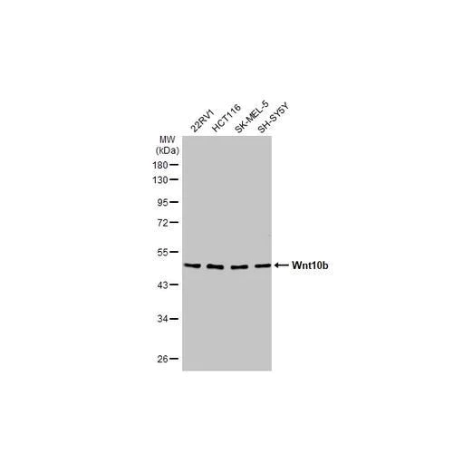 Western blot - Anti-Wnt10b antibody [HL2370] (AB317211)