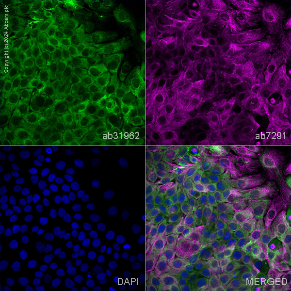 Immunocytochemistry/ Immunofluorescence - Anti-Wnt11 antibody (AB31962)