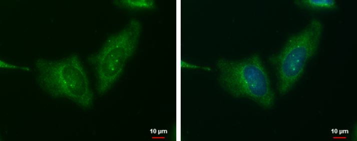 Immunocytochemistry/ Immunofluorescence - Anti-Wnt11 antibody (ab96730), expandable thumbnail