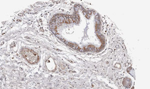 Immunohistochemistry (Formalin/PFA-fixed paraffin-embedded sections) - Anti-Wnt11 antibody (AB96730), expandable thumbnail