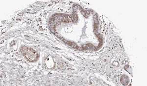 Immunohistochemistry (Formalin/PFA-fixed paraffin-embedded sections) - Anti-Wnt11 antibody (AB96730)
