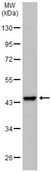 Western blot - Anti-Wnt11 antibody (ab96730), expandable thumbnail