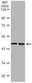 Western blot - Anti-Wnt11 antibody (AB96730), expandable thumbnail