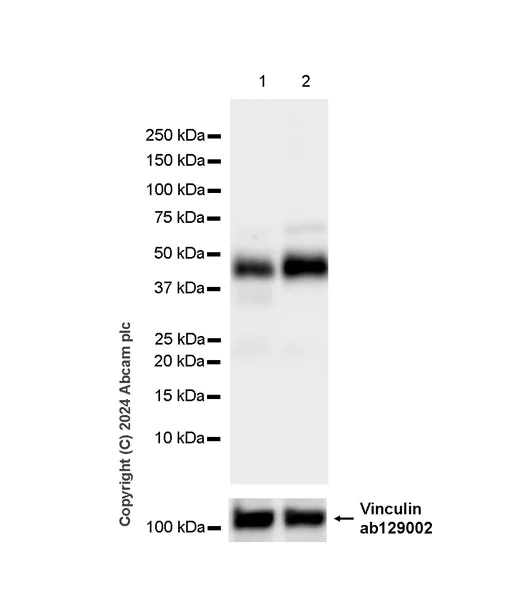 Western blot - Anti-Wnt11 antibody [EPR25633-141] (AB316738)