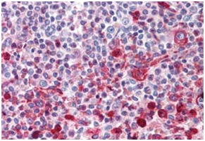 Immunohistochemistry (Formalin/PFA-fixed paraffin-embedded sections) - Anti-Wnt16 antibody (AB189033)