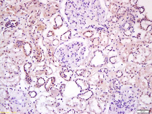 Immunohistochemistry (Formalin/PFA-fixed paraffin-embedded sections) - Anti-Wnt16 antibody (AB217962)