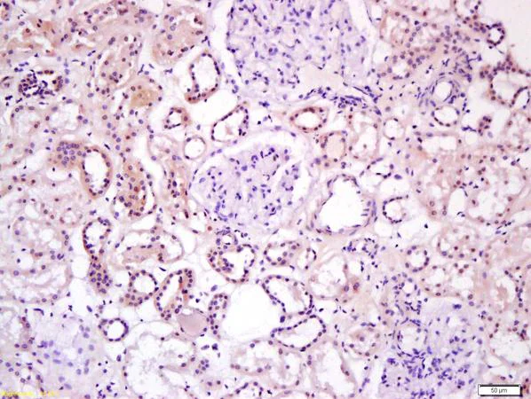Immunohistochemistry (Formalin/PFA-fixed paraffin-embedded sections) - Anti-Wnt16 antibody (AB217962)