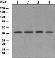 Western blot - Anti-Wnt16 antibody [EPR6064] (AB109437)